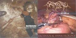 Abort Mastication / Patisserie- Stabbed.. Unknow Putridities Spl
