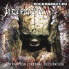 Acephala- Infraction Cerebral Occupation CD on More H*te Prod.