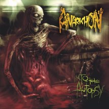 ANARKHON- Into The Autopsy CD on SEVARED RECORDS