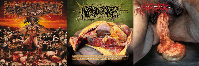 Bowel Stew / Hipermenorrea / Paracoccidioidomicosis- Split CD