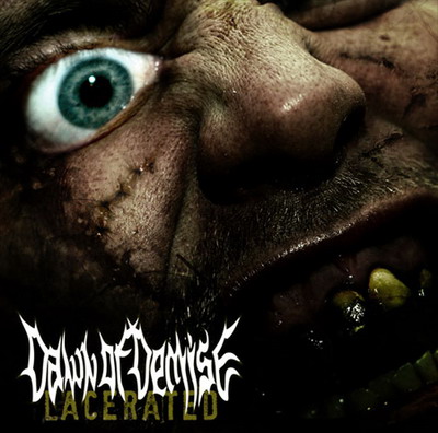 Dawn Of Demise- Lacerated MCD on Deepsend Rec.