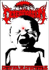 Deterioration- Preventing The Progression.. PRO-CDR on Audible E