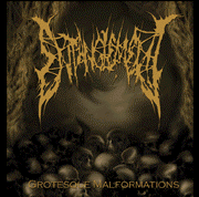 Entanglement- Grotesque Malformations MCD on Sick Vision Media
