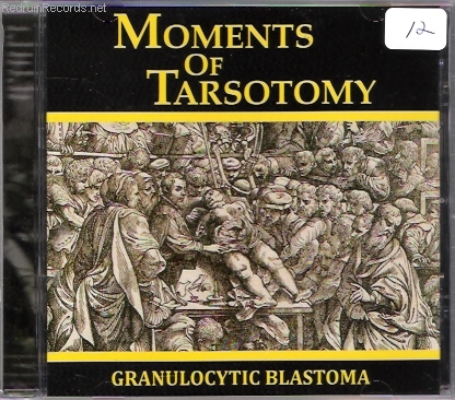 Granulocytic Blastoma- Moments Of Tarsotomy CD on Last House On