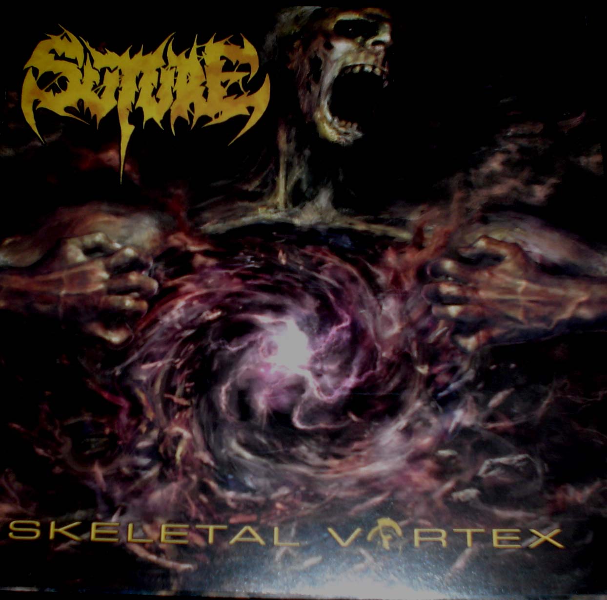 Suture- Skeletal Vortex CD on Unmatched Brutality Rec.