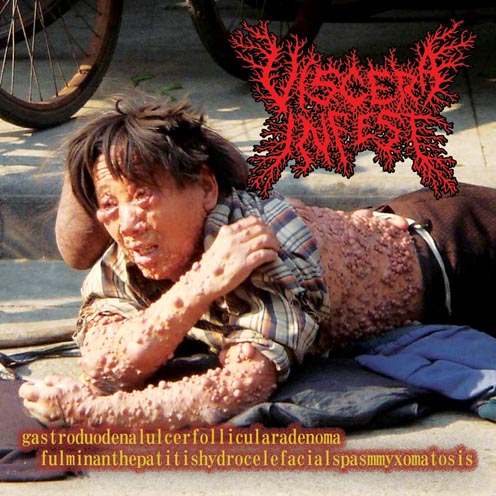 Viscera Infest / Paracoccidodomico..- Split CD on Alarma Rec.
